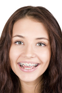 ortho-braces-teensmiling