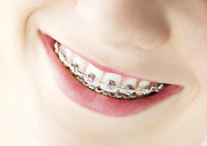 wpid-orthodontics-whole-body_24493259